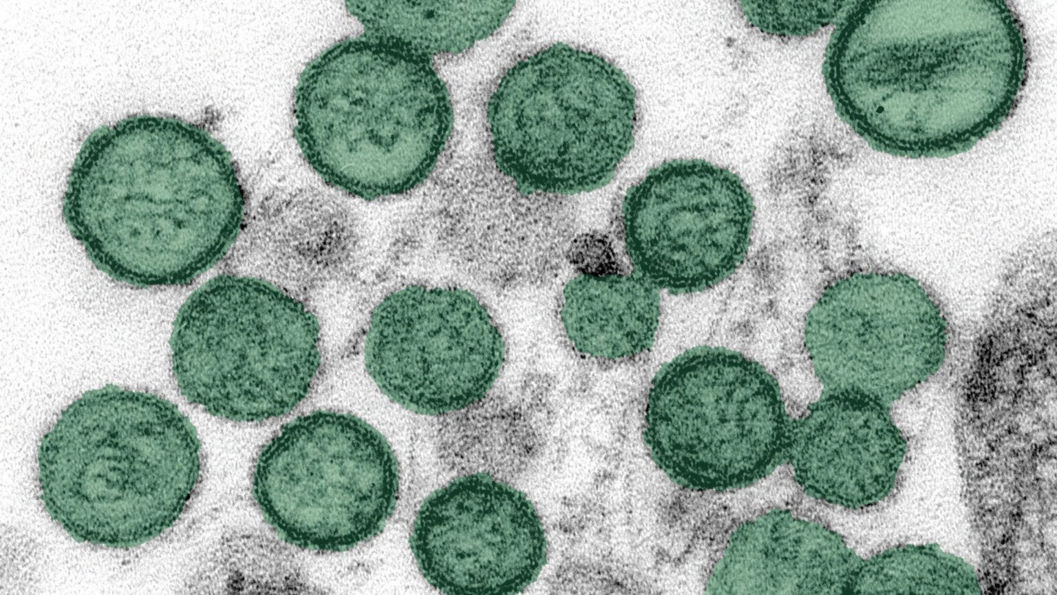 Picnet Andes Virus | PICNet